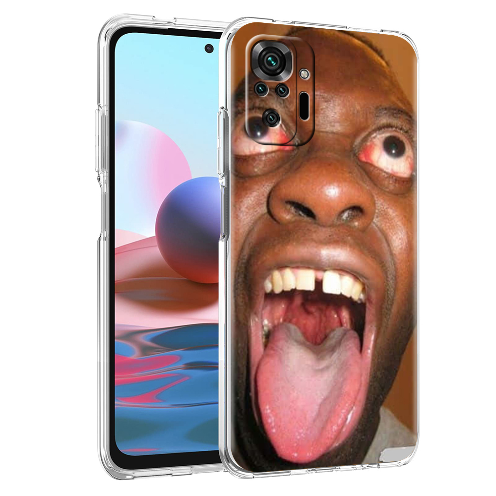 เคสโทรศัพท์ใสลายตลกสำหรับ Redm - Phone Cases Ugly บทวิจารณ์และราคา